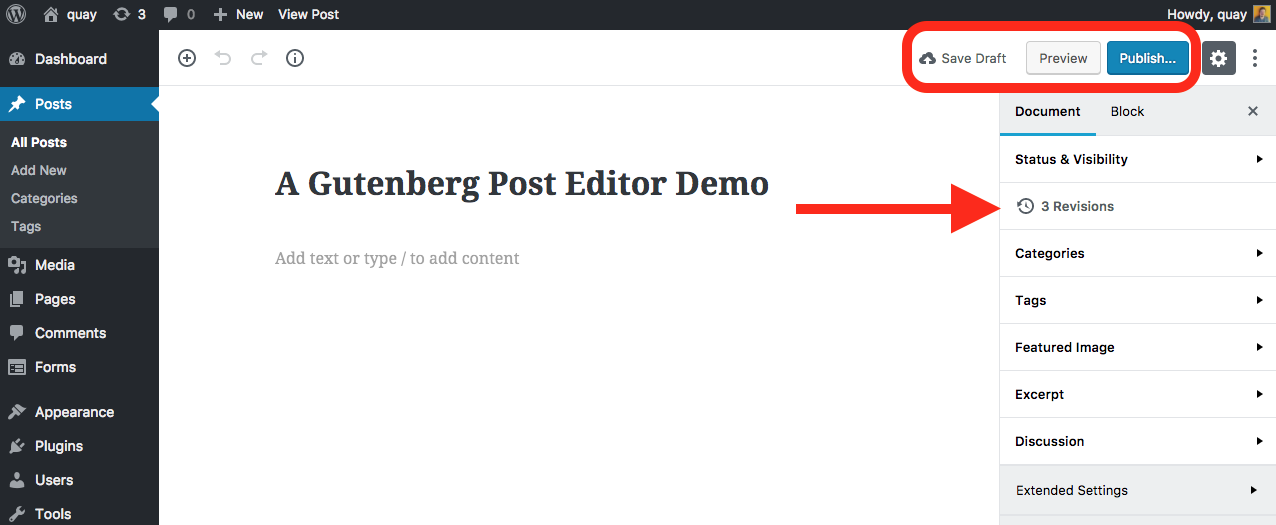 gutenberg editor revisions feature
